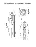 METHOD AND APPARATUS FOR HYSTEROSCOPY AND ENDOMETRIAL BIOPSY diagram and image