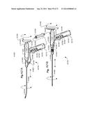 METHOD AND APPARATUS FOR HYSTEROSCOPY AND ENDOMETRIAL BIOPSY diagram and image