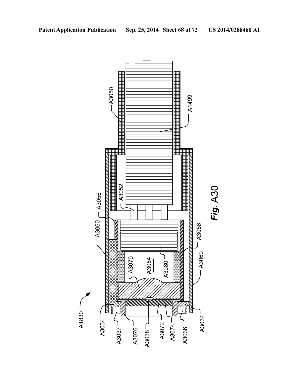 METHOD AND APPARATUS FOR HYSTEROSCOPY AND ENDOMETRIAL BIOPSY - diagram, schematic, and image 69