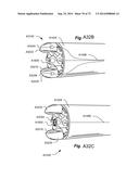 METHOD AND APPARATUS FOR HYSTEROSCOPY AND ENDOMETRIAL BIOPSY diagram and image