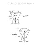 METHOD AND APPARATUS FOR HYSTEROSCOPY AND ENDOMETRIAL BIOPSY diagram and image