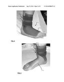 ANKLE-FOOT ORTHOSES diagram and image