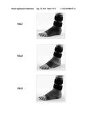 ANKLE-FOOT ORTHOSES diagram and image