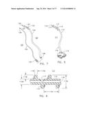 Rotate-to-Advance Catheterization System diagram and image