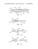 Rotate-to-Advance Catheterization System diagram and image