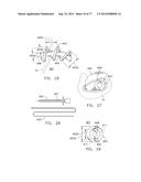 Rotate-to-Advance Catheterization System diagram and image