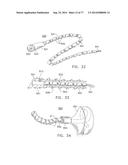 Rotate-to-Advance Catheterization System diagram and image