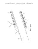 Rotate-to-Advance Catheterization System diagram and image