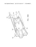 Rotate-to-Advance Catheterization System diagram and image