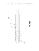 Rotate-to-Advance Catheterization System diagram and image