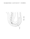 Rotate-to-Advance Catheterization System diagram and image