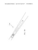 Rotate-to-Advance Catheterization System diagram and image