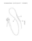 Rotate-to-Advance Catheterization System diagram and image