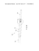 Rotate-to-Advance Catheterization System diagram and image