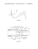 Rotate-to-Advance Catheterization System diagram and image