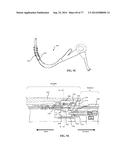 Rotate-to-Advance Catheterization System diagram and image