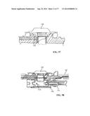 Rotate-to-Advance Catheterization System diagram and image