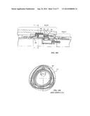 Rotate-to-Advance Catheterization System diagram and image