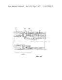 Rotate-to-Advance Catheterization System diagram and image