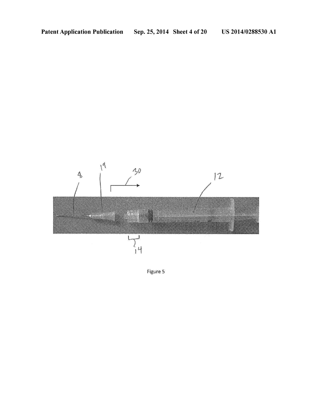 SYSTEM AND METHOD FOR ADAPTABLE SAFETY SYRINGE - diagram, schematic, and image 05