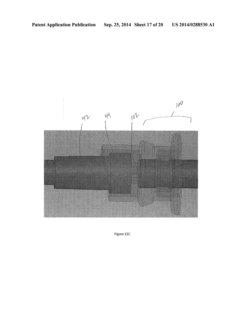 SYSTEM AND METHOD FOR ADAPTABLE SAFETY SYRINGE - diagram, schematic, and image 18