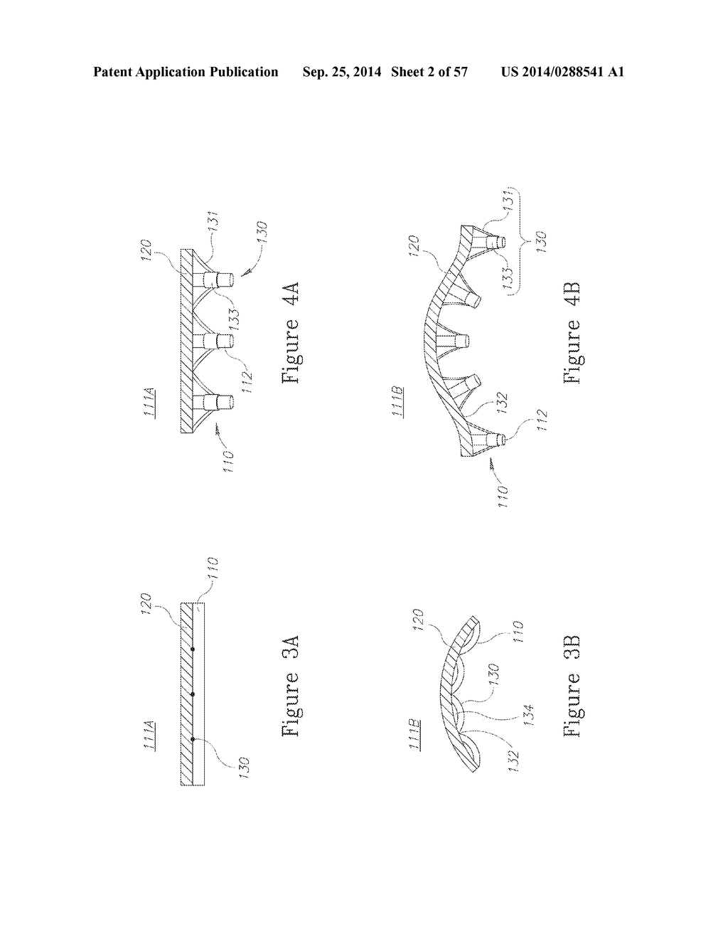 LESION TREATMENT DEVICE AND METHODS FOR TREATING LESIONS - diagram, schematic, and image 03