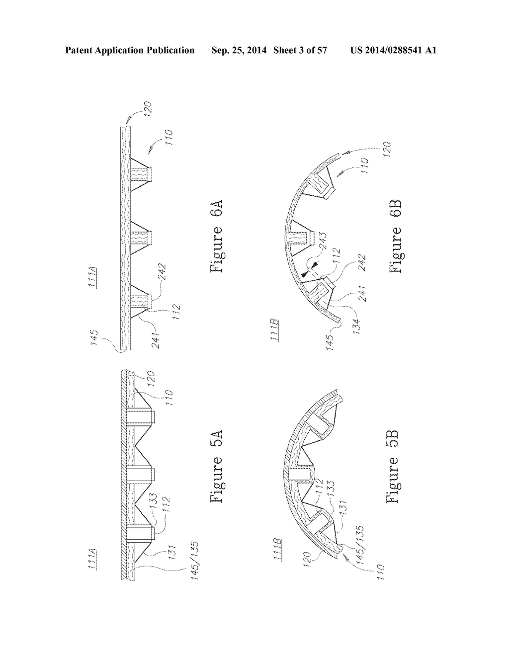 LESION TREATMENT DEVICE AND METHODS FOR TREATING LESIONS - diagram, schematic, and image 04