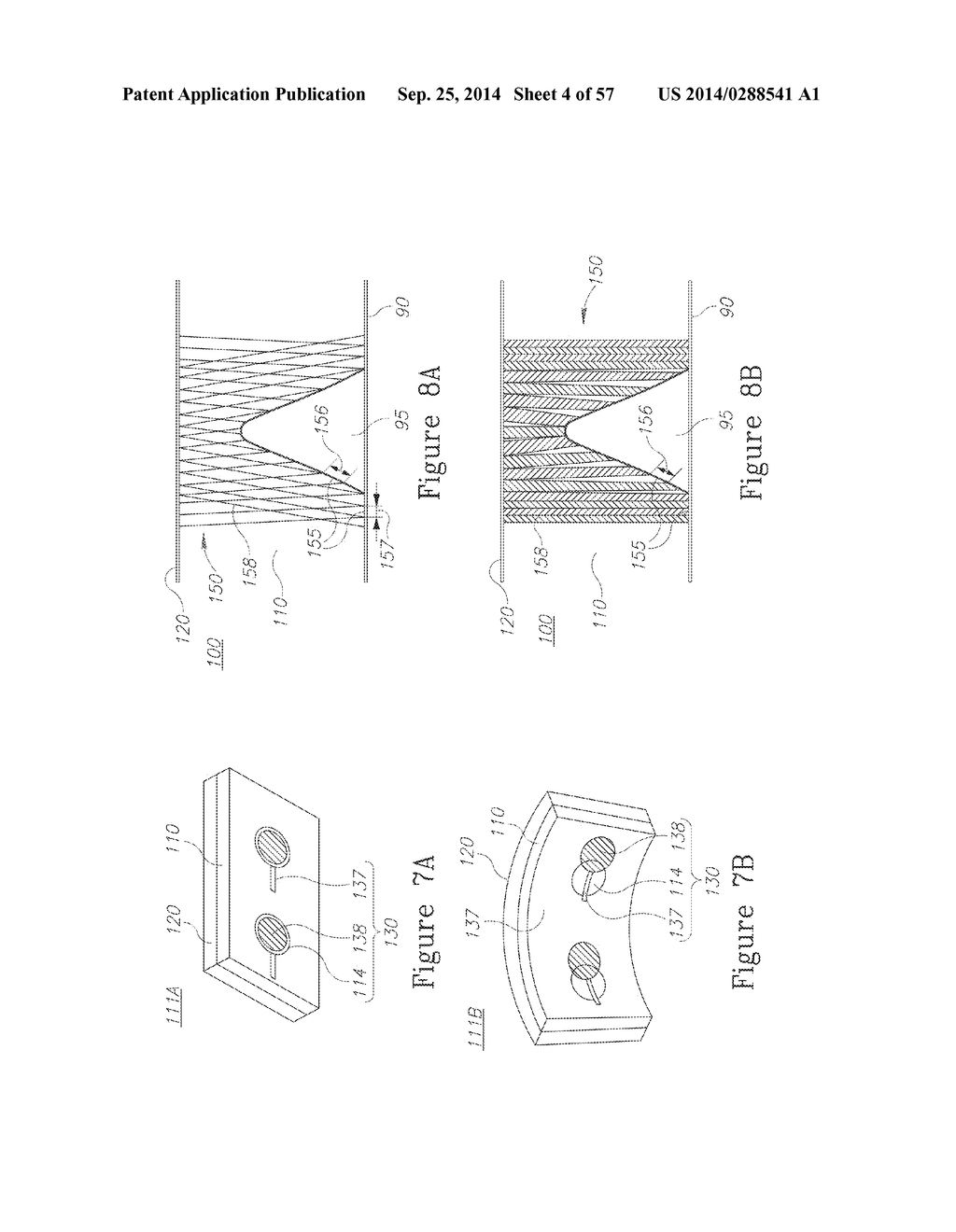 LESION TREATMENT DEVICE AND METHODS FOR TREATING LESIONS - diagram, schematic, and image 05