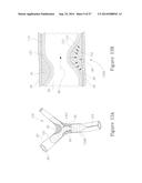 LESION TREATMENT DEVICE AND METHODS FOR TREATING LESIONS diagram and image