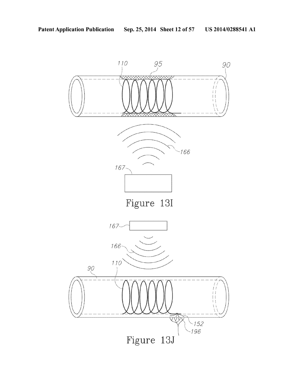 LESION TREATMENT DEVICE AND METHODS FOR TREATING LESIONS - diagram, schematic, and image 13