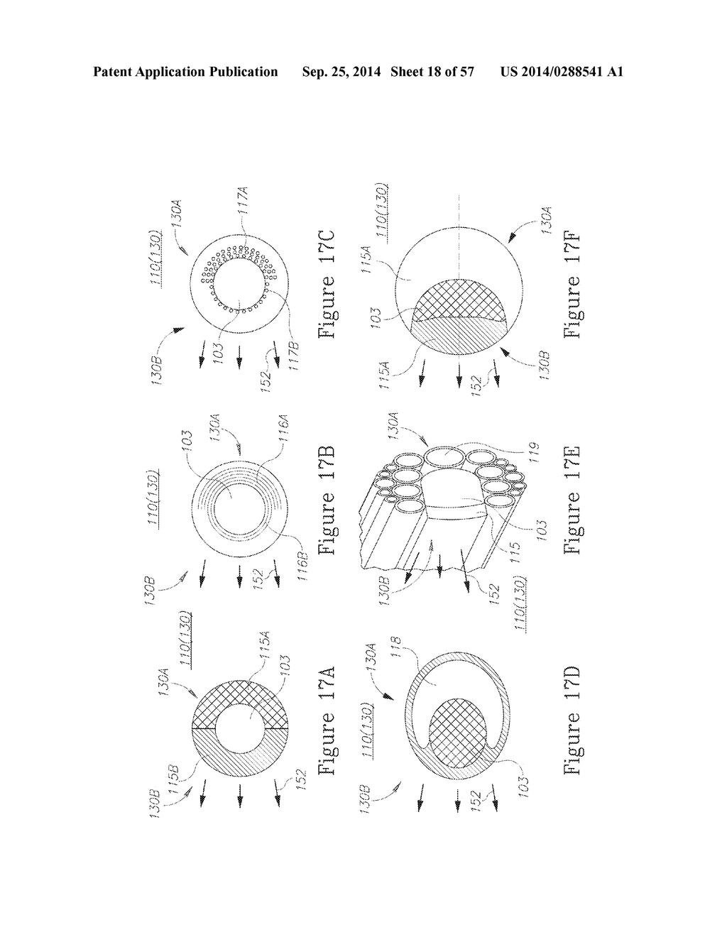 LESION TREATMENT DEVICE AND METHODS FOR TREATING LESIONS - diagram, schematic, and image 19