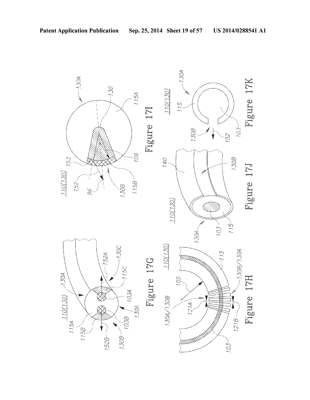 LESION TREATMENT DEVICE AND METHODS FOR TREATING LESIONS - diagram, schematic, and image 20