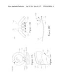 LESION TREATMENT DEVICE AND METHODS FOR TREATING LESIONS diagram and image