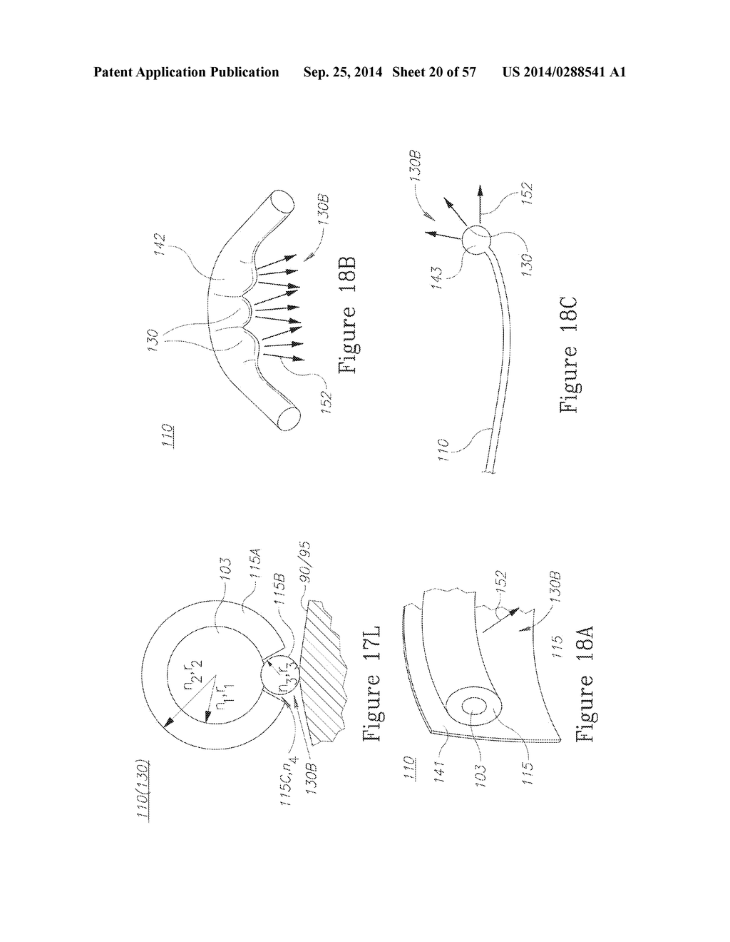 LESION TREATMENT DEVICE AND METHODS FOR TREATING LESIONS - diagram, schematic, and image 21