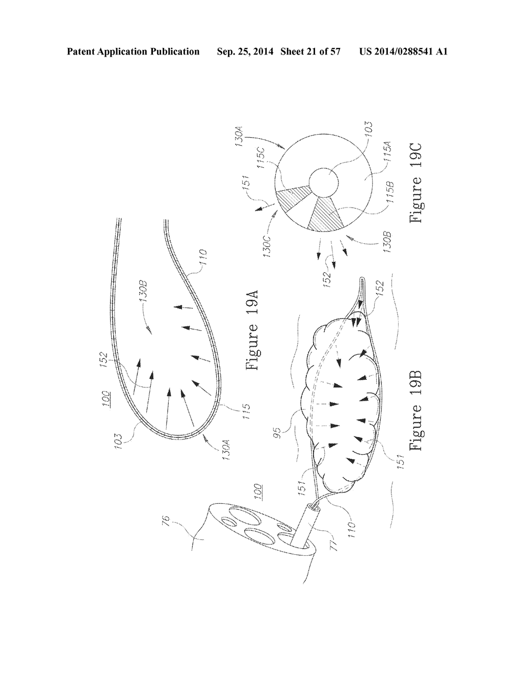 LESION TREATMENT DEVICE AND METHODS FOR TREATING LESIONS - diagram, schematic, and image 22