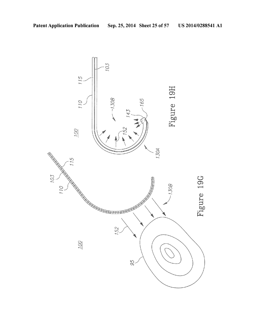 LESION TREATMENT DEVICE AND METHODS FOR TREATING LESIONS - diagram, schematic, and image 26