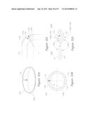 LESION TREATMENT DEVICE AND METHODS FOR TREATING LESIONS diagram and image