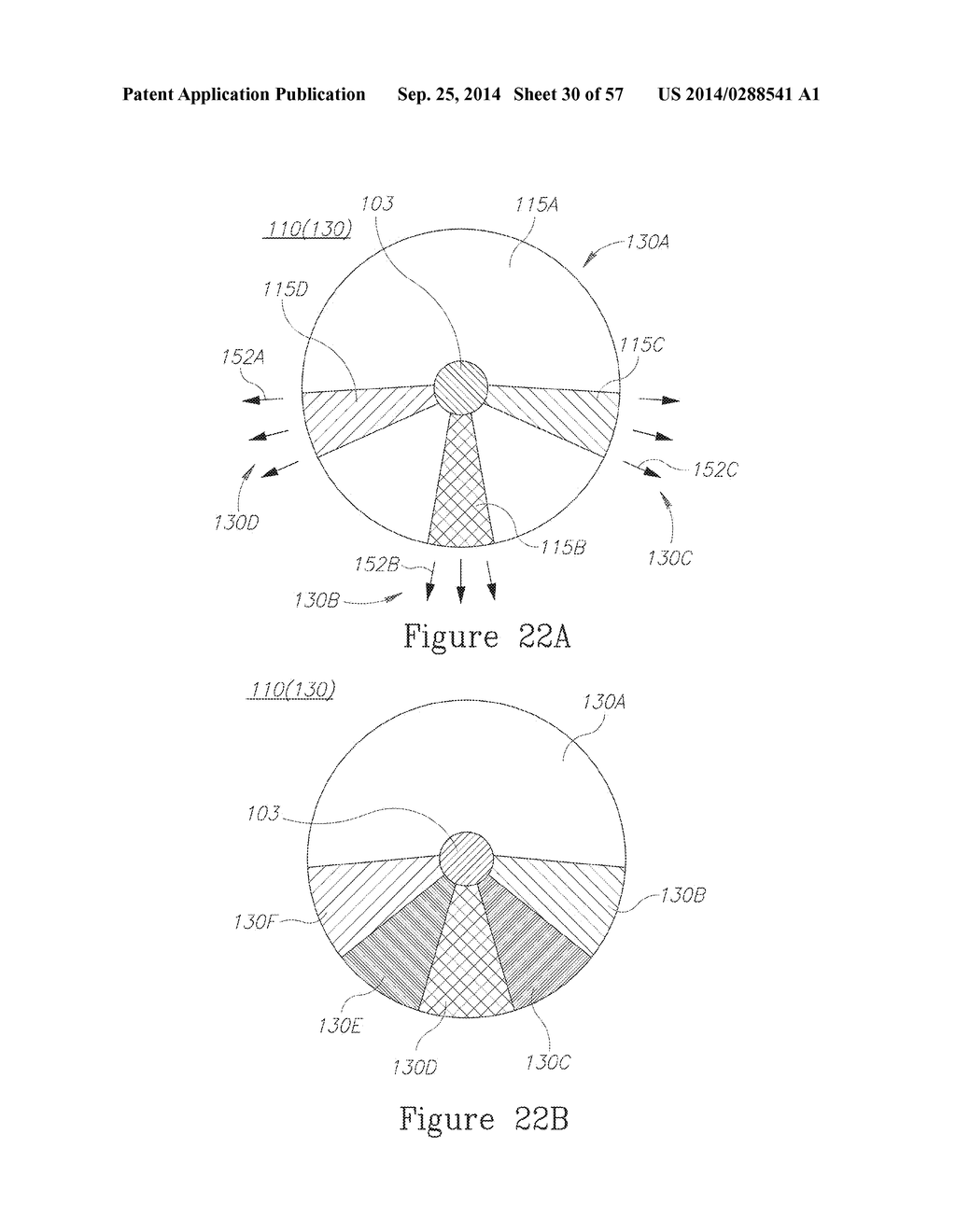 LESION TREATMENT DEVICE AND METHODS FOR TREATING LESIONS - diagram, schematic, and image 31