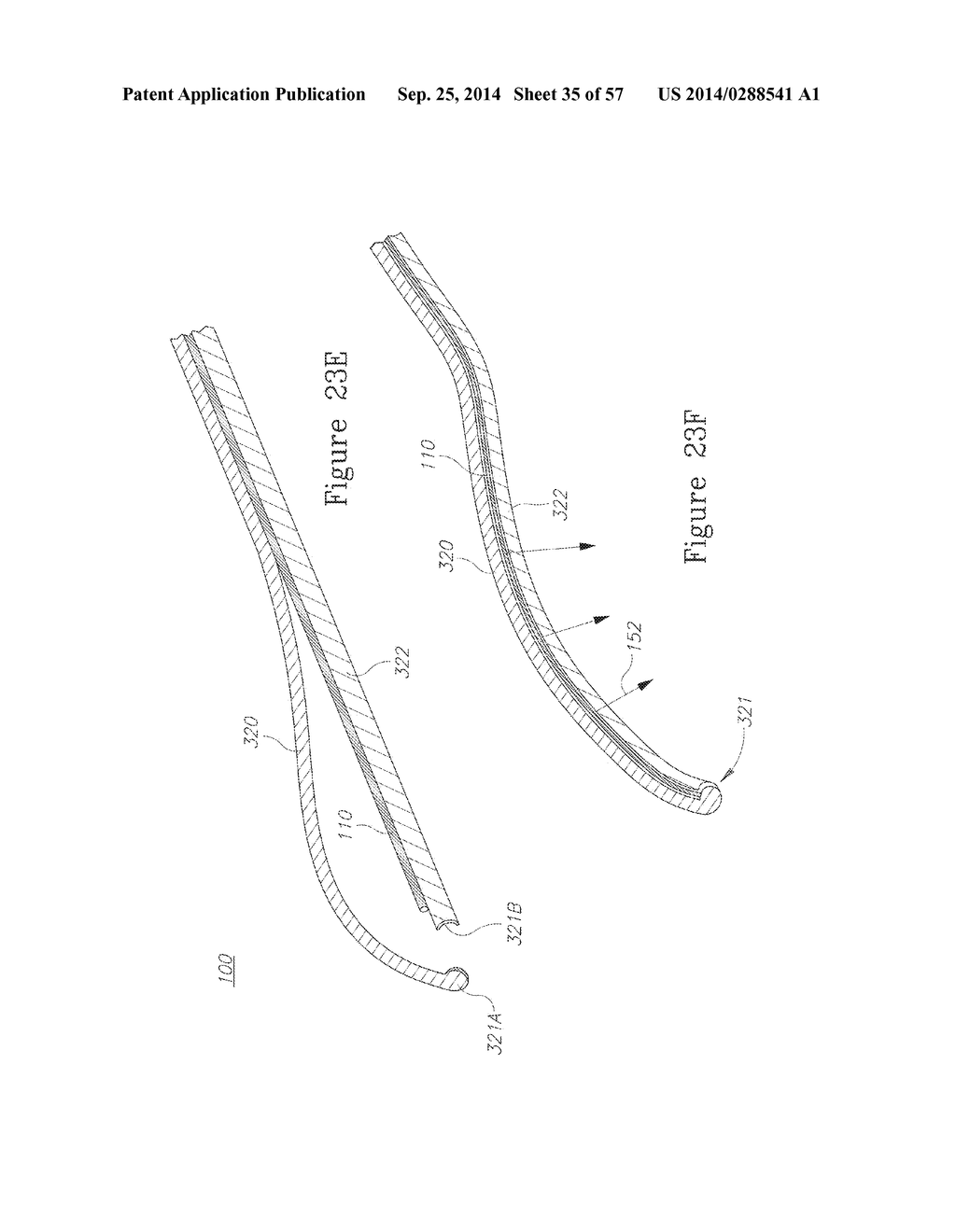 LESION TREATMENT DEVICE AND METHODS FOR TREATING LESIONS - diagram, schematic, and image 36