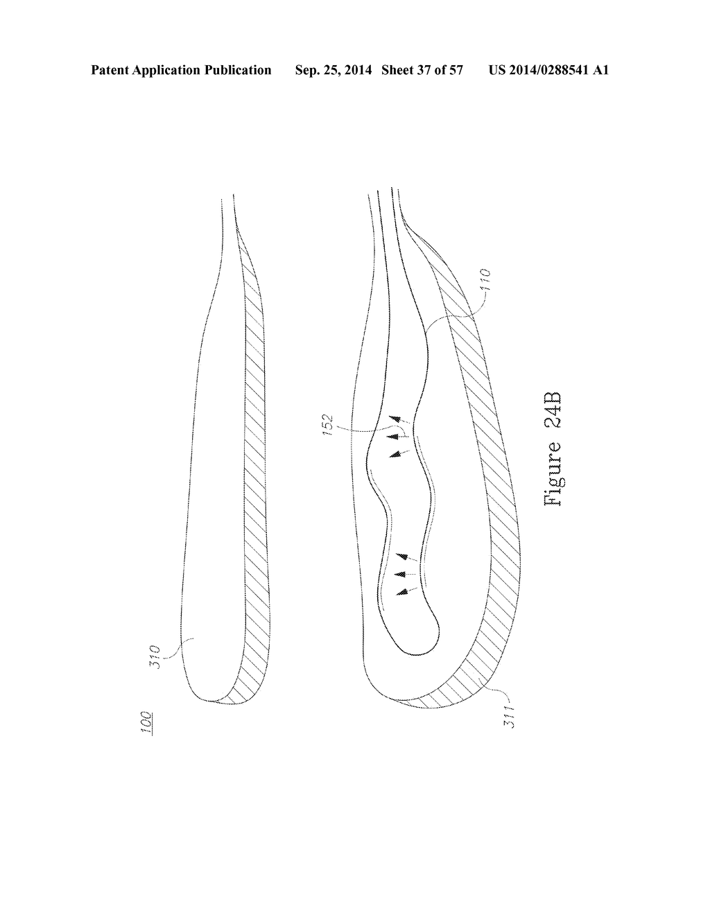 LESION TREATMENT DEVICE AND METHODS FOR TREATING LESIONS - diagram, schematic, and image 38