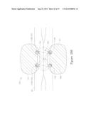 LESION TREATMENT DEVICE AND METHODS FOR TREATING LESIONS diagram and image