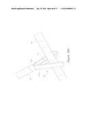 LESION TREATMENT DEVICE AND METHODS FOR TREATING LESIONS diagram and image