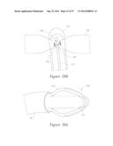 LESION TREATMENT DEVICE AND METHODS FOR TREATING LESIONS diagram and image