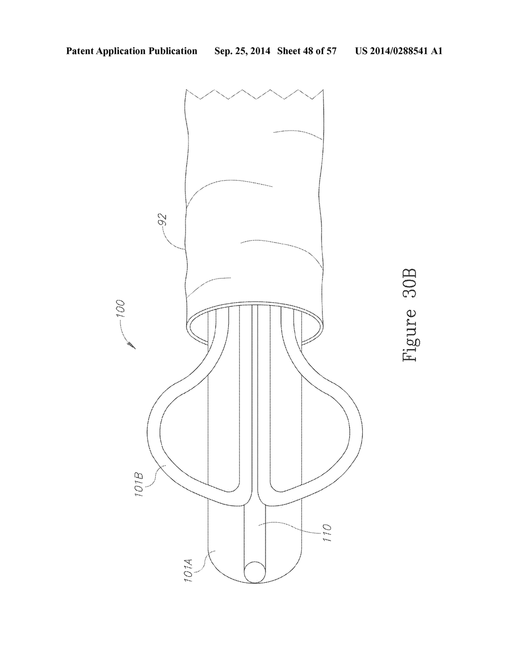 LESION TREATMENT DEVICE AND METHODS FOR TREATING LESIONS - diagram, schematic, and image 49