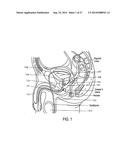 SYSTEMS AND METHODS FOR PROSTATE TREATMENT diagram and image