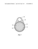 SYSTEMS AND METHODS FOR PROSTATE TREATMENT diagram and image