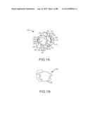 CARDIAC ABLATION SYSTEMS AND METHODS diagram and image