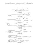 CARDIAC ABLATION SYSTEMS AND METHODS diagram and image