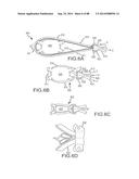 CARDIAC ABLATION SYSTEMS AND METHODS diagram and image