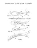 CARDIAC ABLATION SYSTEMS AND METHODS diagram and image